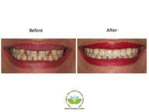 Cosmetic Dentistry