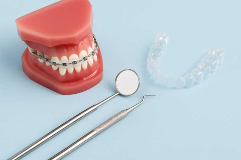 Dental model with braces, a clear aligner, a dental mirror, and a dental probe displayed on a light blue background—showcasing adult orthodontics options.